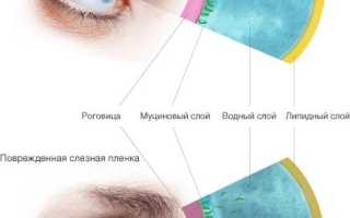 Синдром сухого глаза щитовидная железа