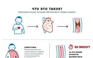Окс с подъемом сегмента st код мкб