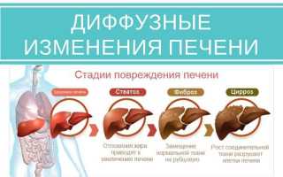 Синдром диффузного поражения печени характерен
