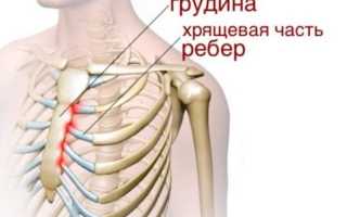 Народное средство от синдрома титце
