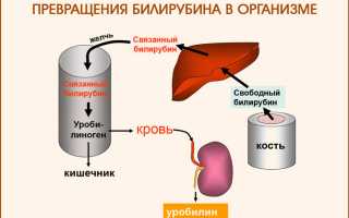 Чем может грозить синдром жильбера