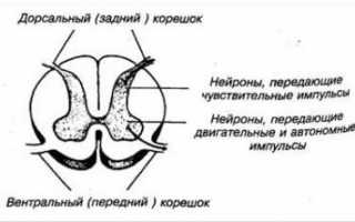 Корешковый синдром при остеохондрозе лечение