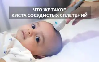 Киста сосудистого сплетения и синдром дауна
