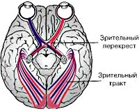 Корковая слепота