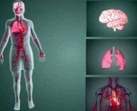 Постреанимационная болезнь
