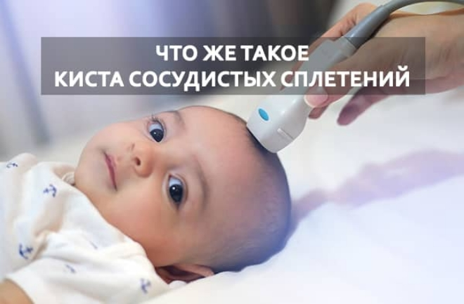 УЗИ мозга ребенка