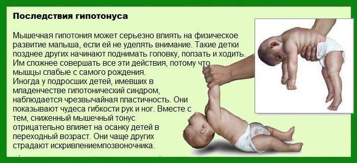 Делаем детский массаж и гимнастику при мышечной дистонии - обзор
