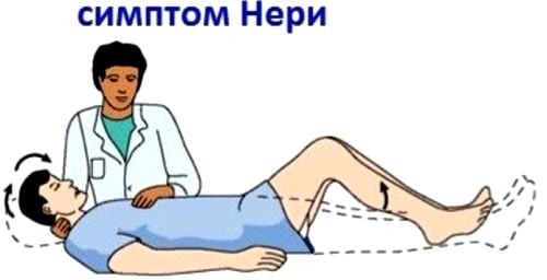 Лечение корешковый синдром при шейном остеохондрозе