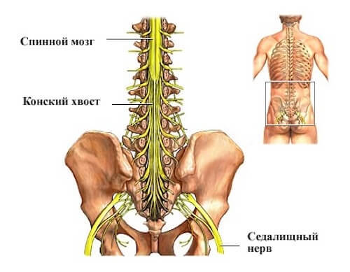 Народные средства для лечения синдрома конского хвоста